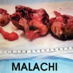 Malachi