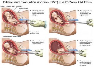 partial_birth_diagram